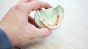 constructed set of dental implants