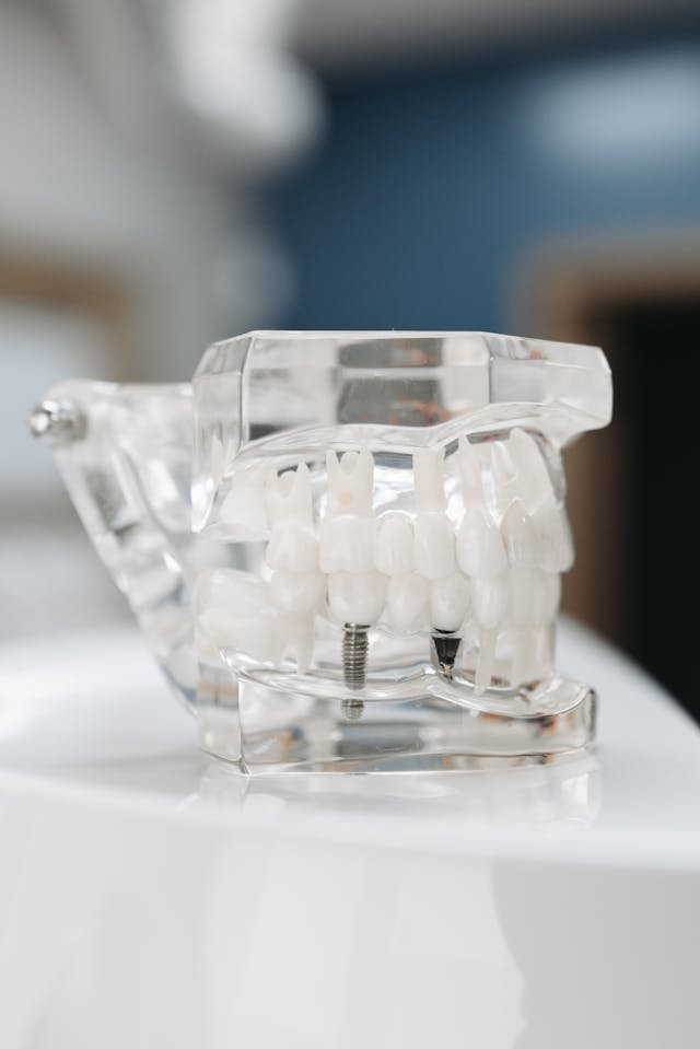 implant secured dentures in Northern VA