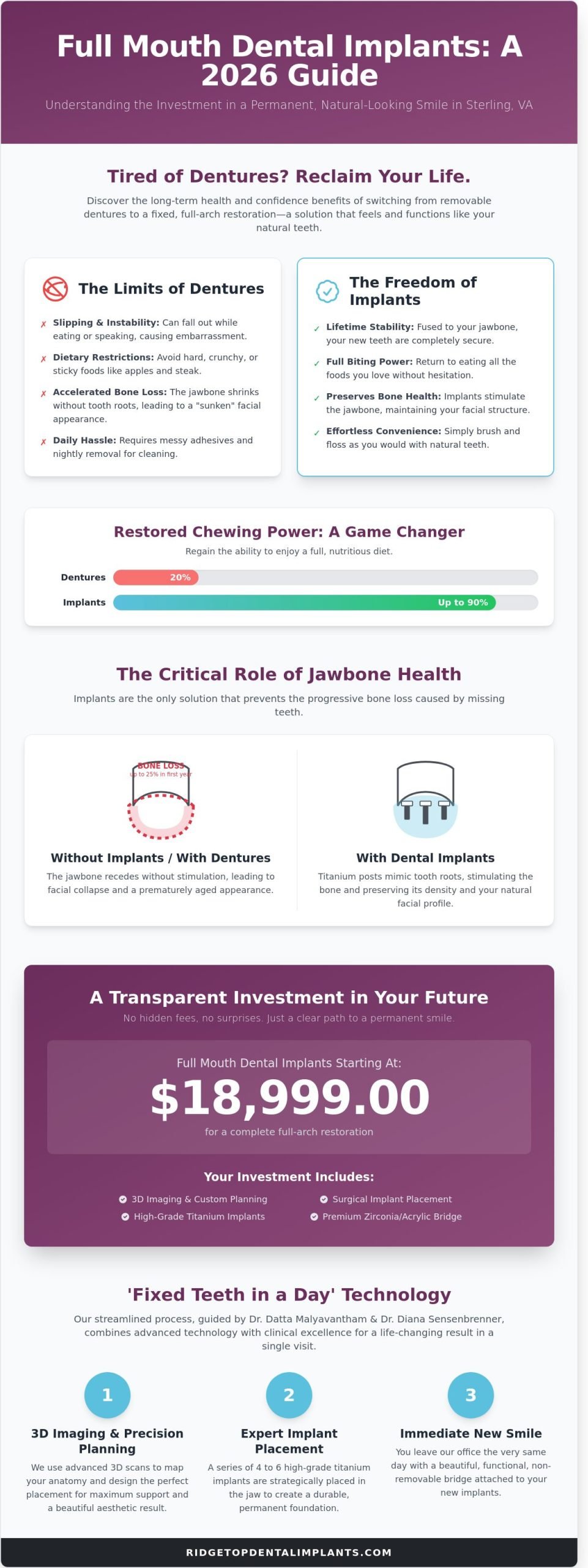 Cost of Full Mouth Dental Implants in Sterling: Your 2026 Price & Value Guide