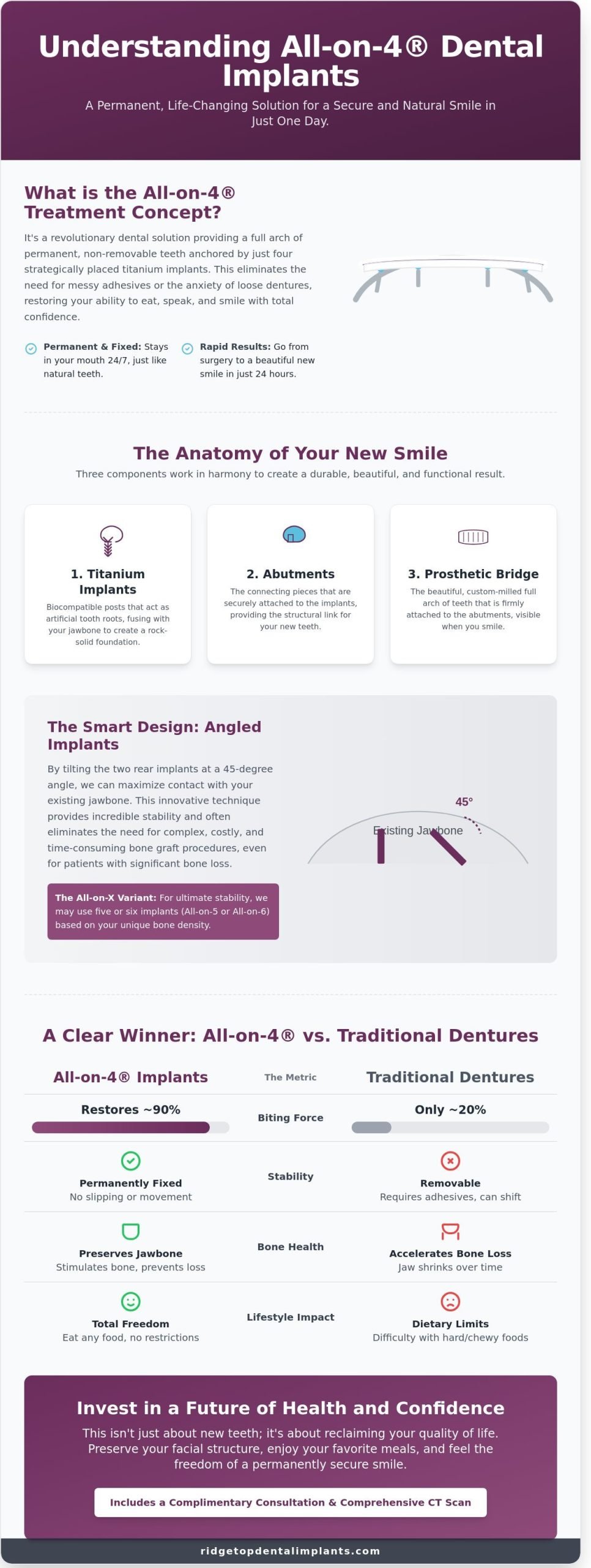 Dental Implant All on Four in Sterling & Northern Virginia: Fixed Teeth in a Day