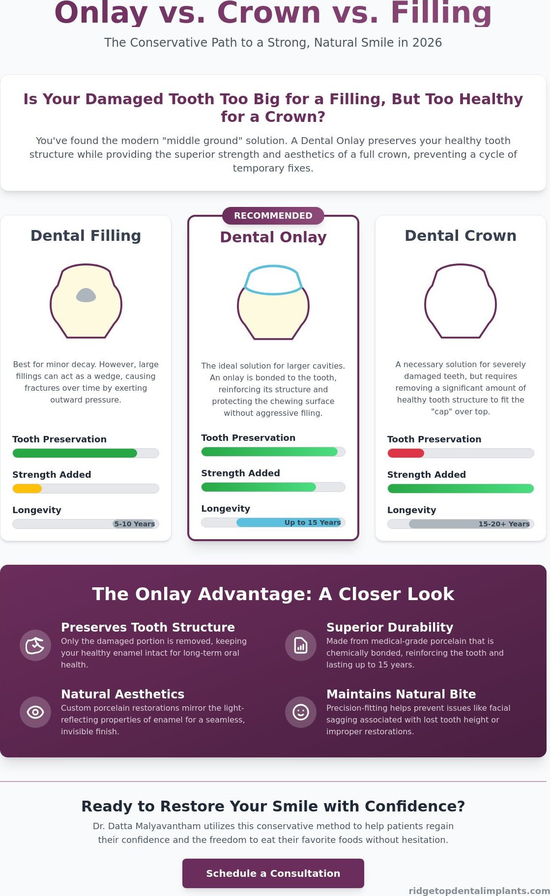 Can a Dental Onlay Save Your Tooth in Sterling, VA? Your 2026 Guide